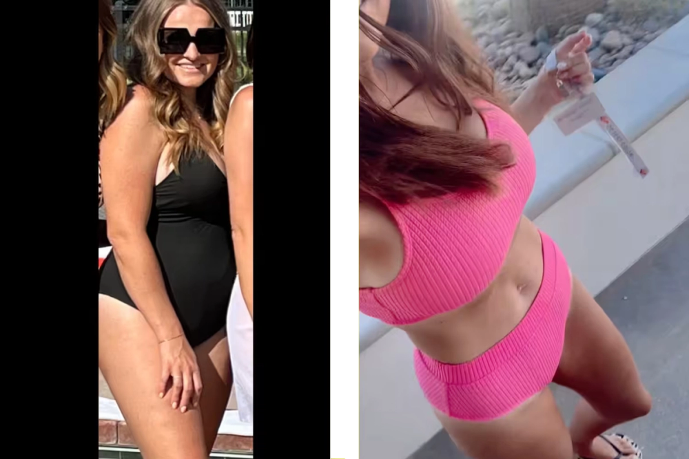 Patient transformation 2