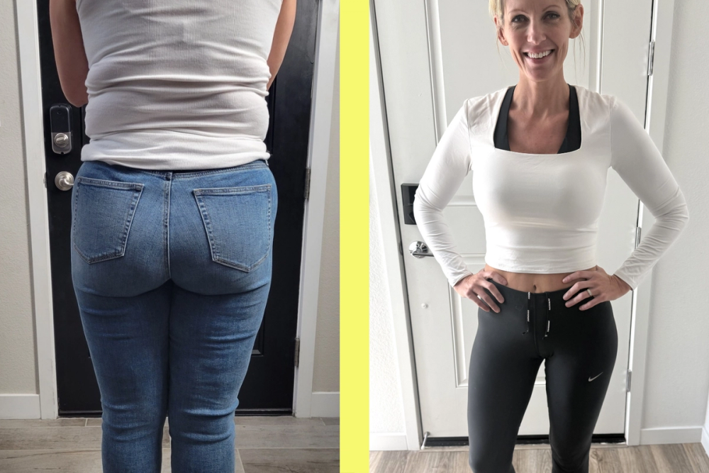 Patient transformation 7