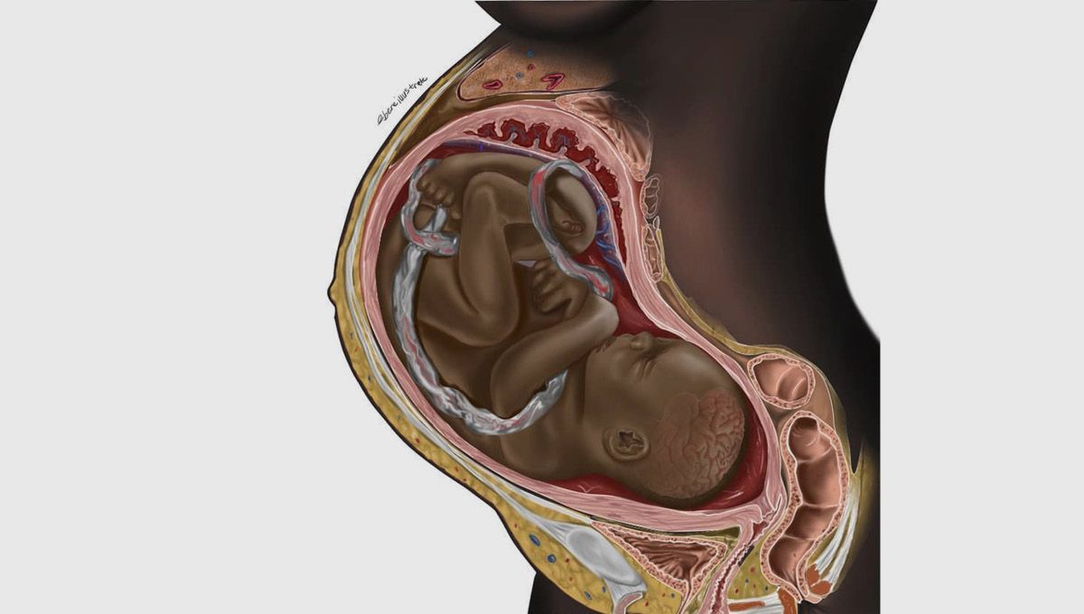 Medical illustration featuring patient with black skin