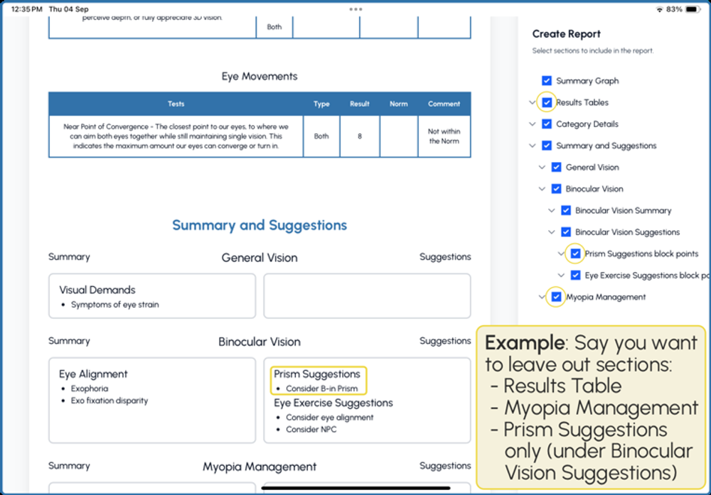 Create Report panel showing checkboxes to include or exclude sections such as Results Tables and Myopia Management