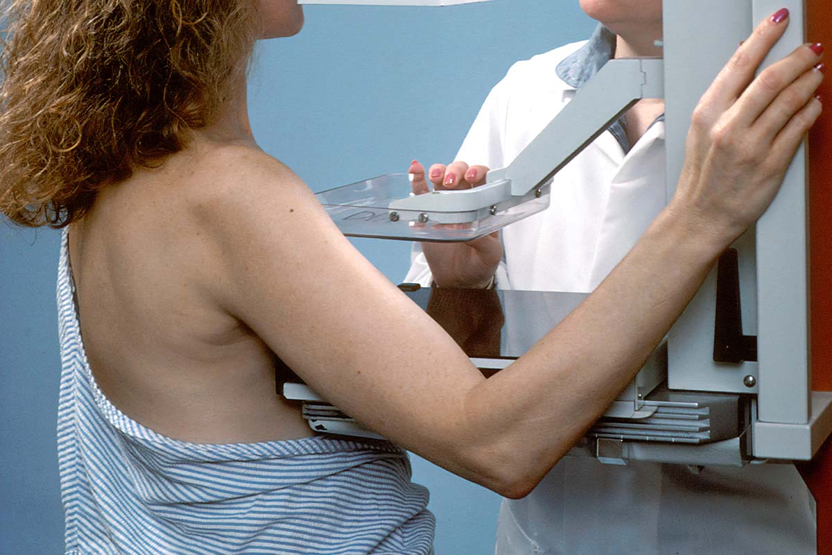 New Guidelines Say Start Regular Mammograms At 40, Not 50