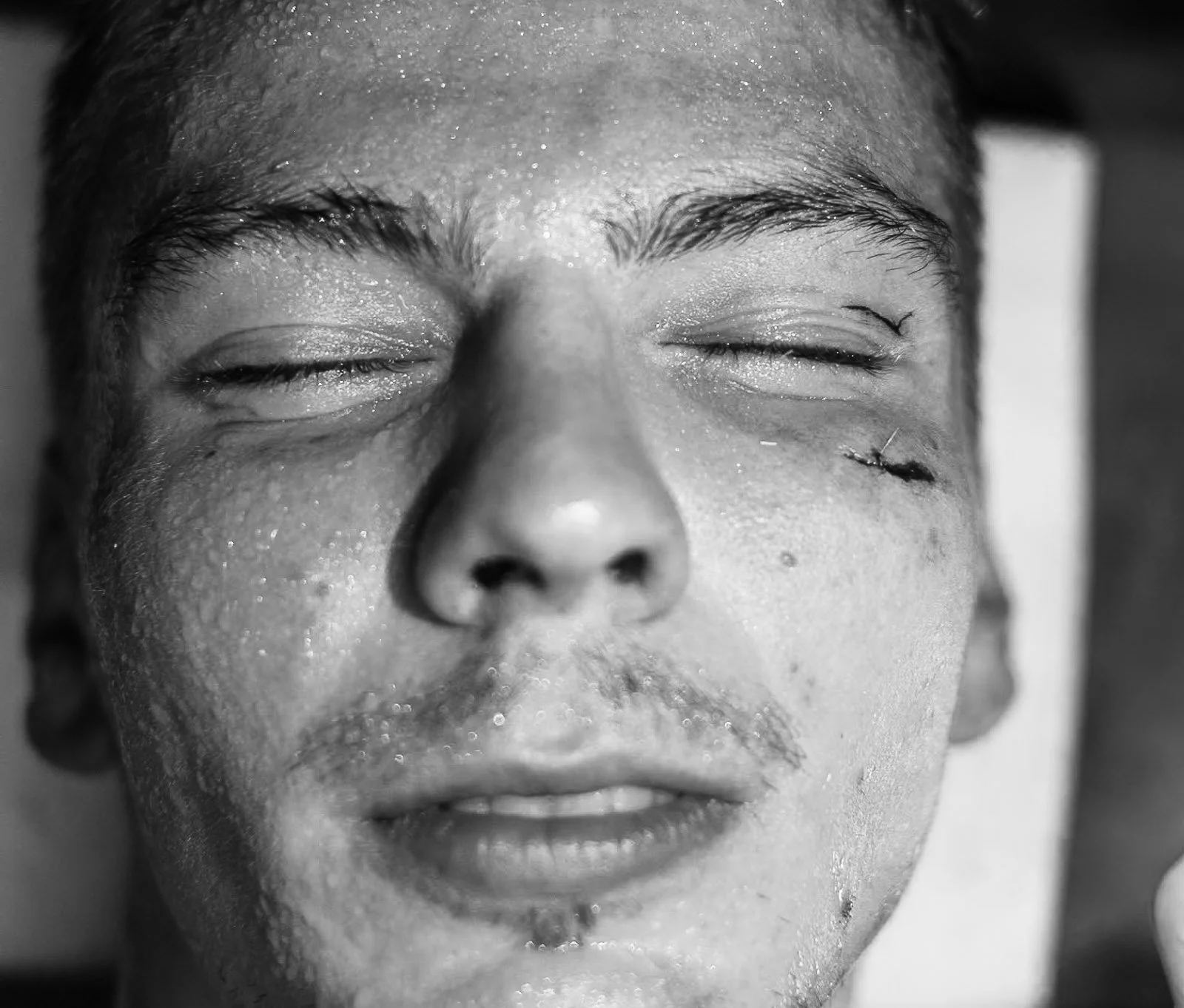 Close-up portrait of a Muay Thai fighter with stitches below his eye