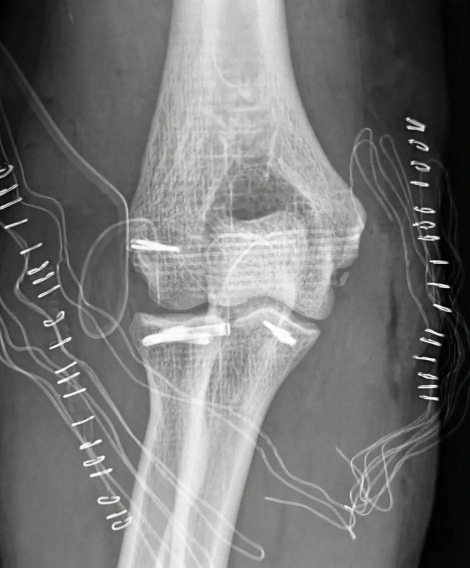 Traumatologia - immagine 1