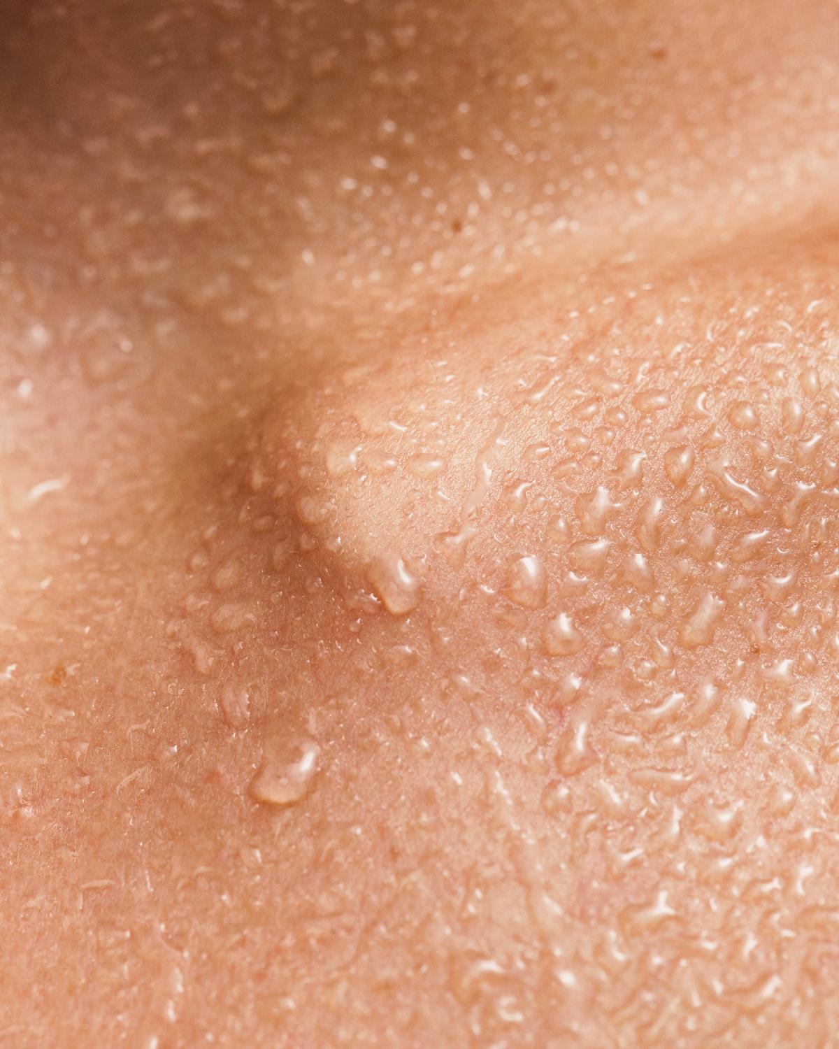 Extreme close-up of warm, peachy skin covered in tiny water droplets, with soft contours and a dewy sheen.
