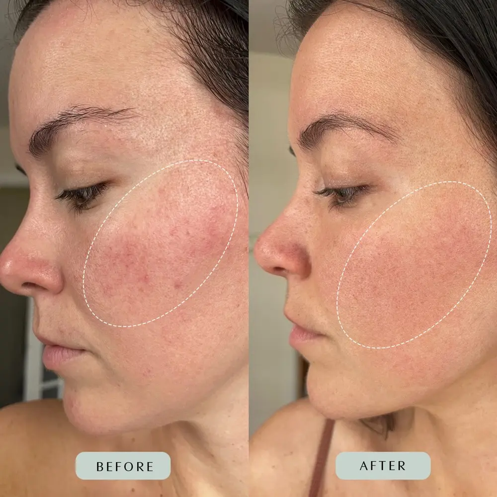 before and after image highlighting results