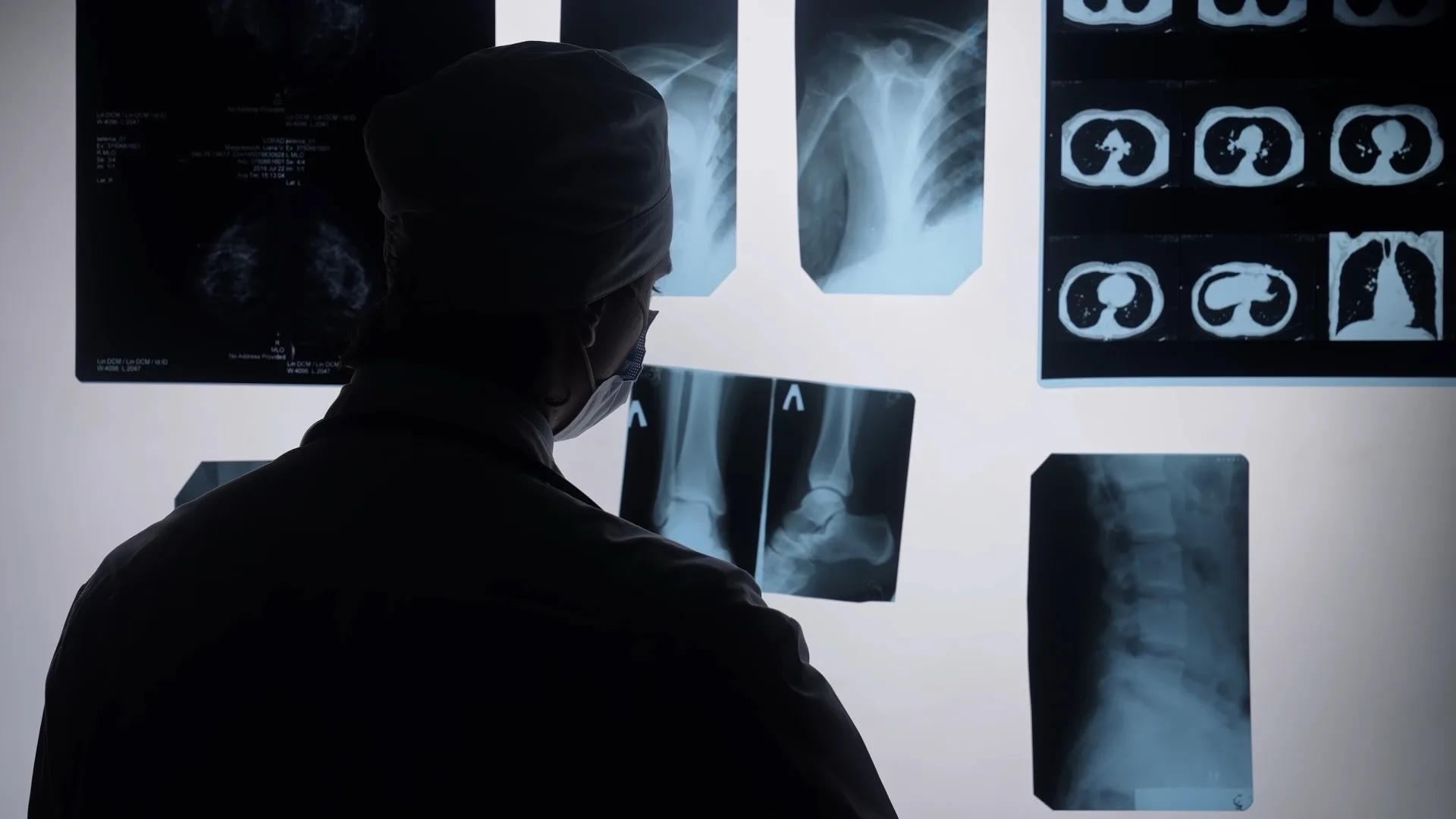 Clinician reviewing X-ray and CT scans on a light board