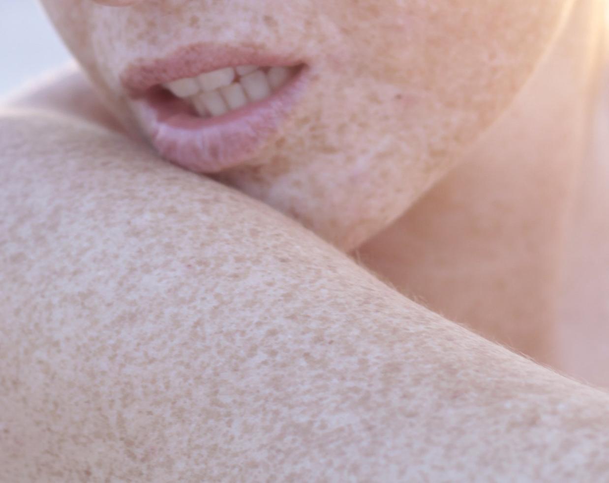 Sensitive or Sensitized Skin? How to Distinguish Between the Two ...