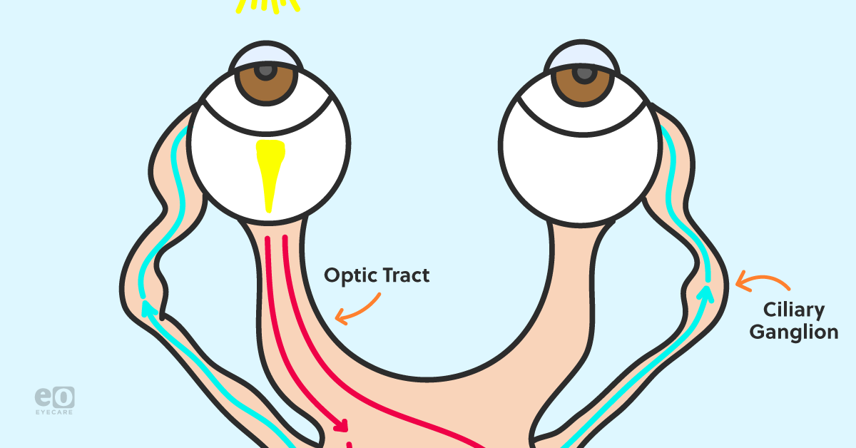 Here S The Easiest Way To Test For An Afferent Pupillary Defect