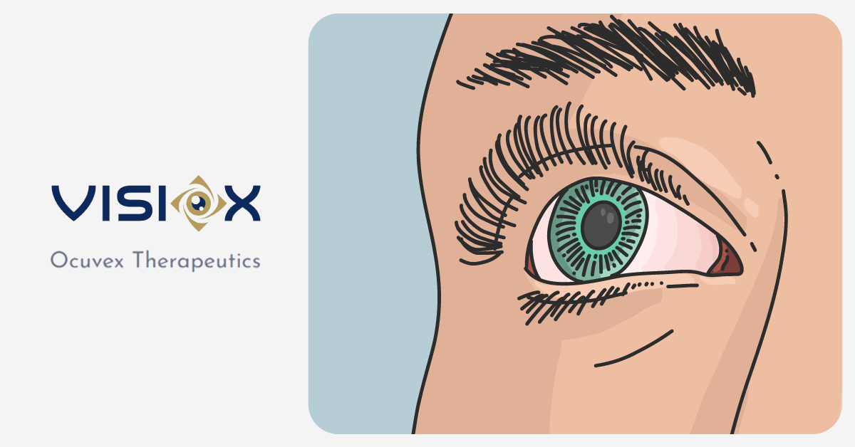 Ocuvex Therapeutics to merge with Visiox Pharmaceuticals