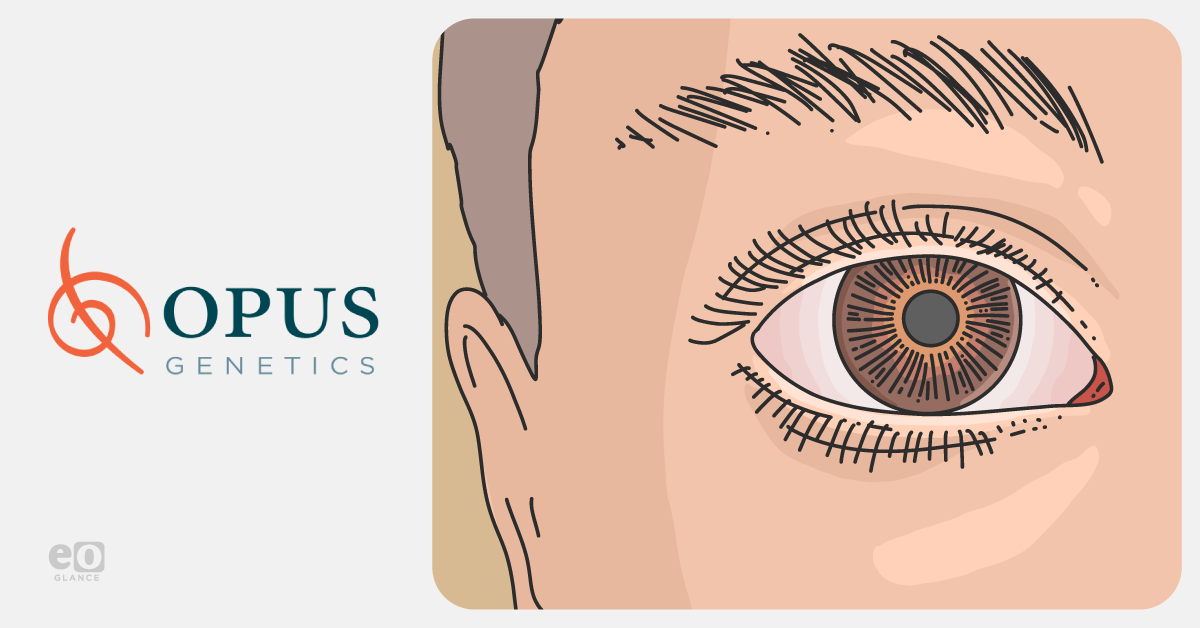 Opus Genetics reports positive pediatric data from LCA5 gene therapy study