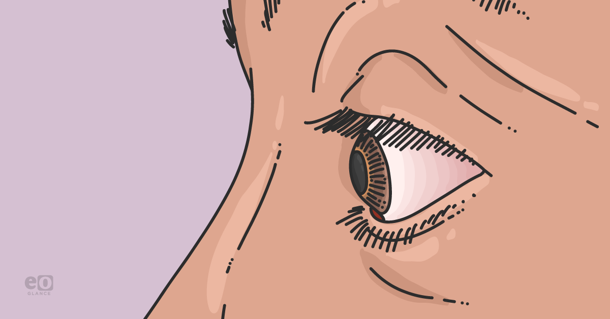 Are corneal dystrophies linked to mental health conditions?