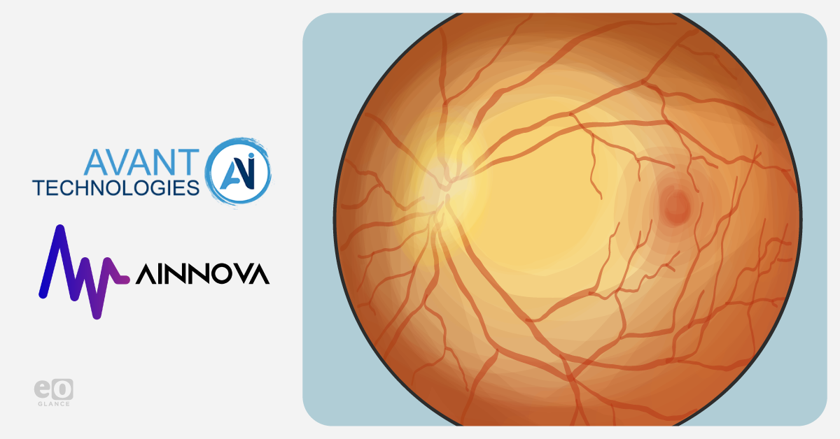 Avant Technologies and Ainnova to advance low-cost retinal camera with AI software