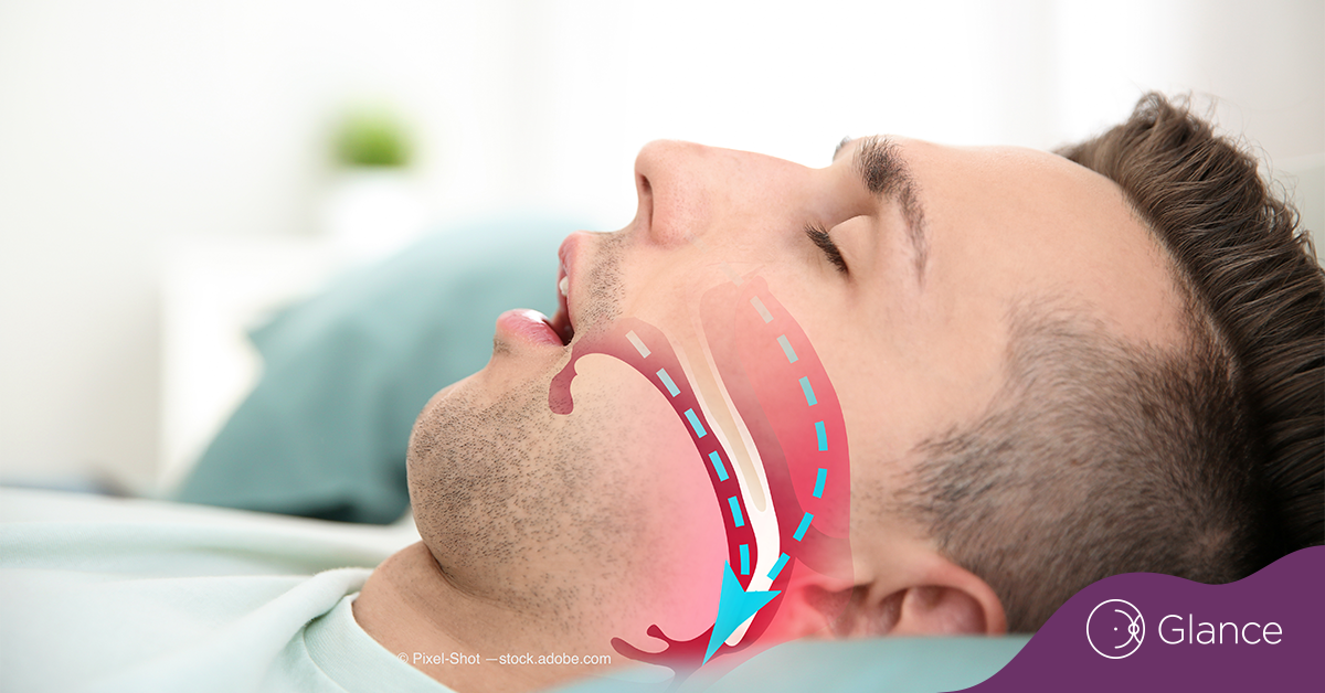 Are and obstructive sleep apnea connected?
