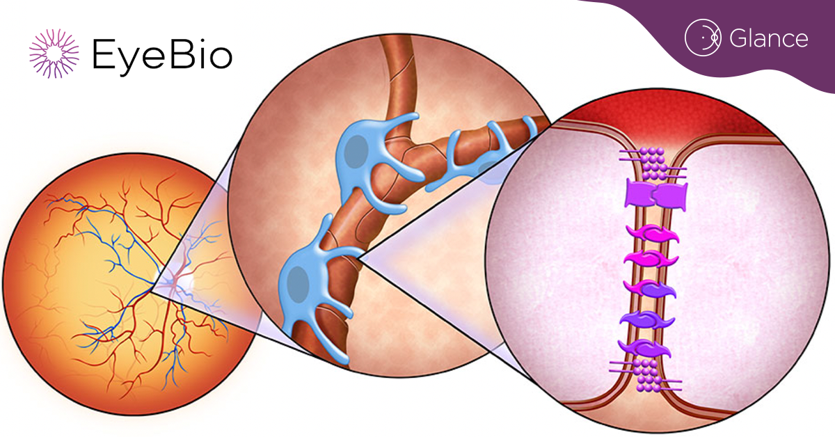 Eyebiotech Limited introduces first retinal disease candidate