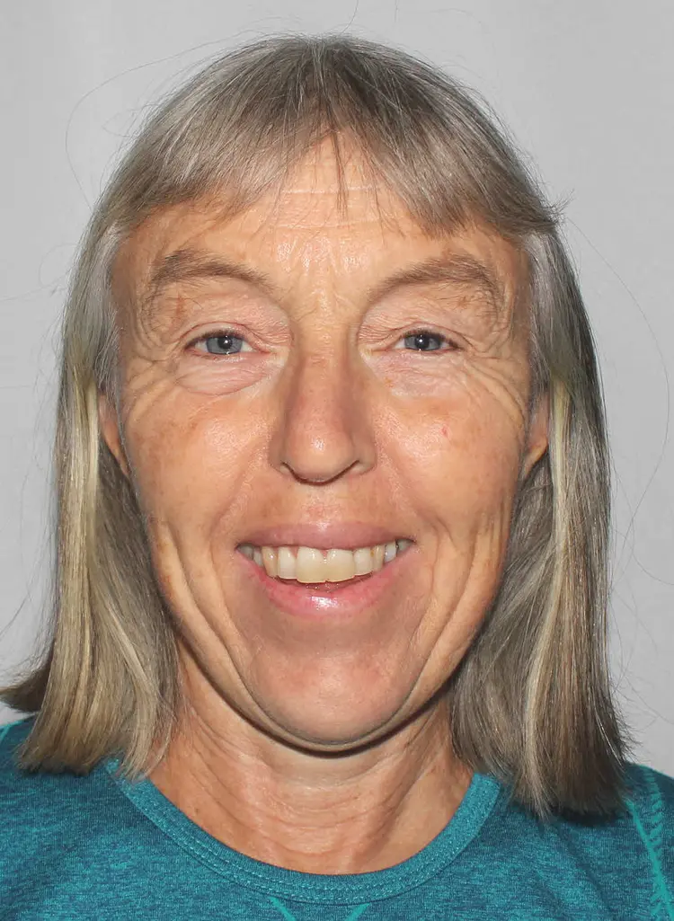 Bidragsyter Gerd Lise M.N. Nordbotten