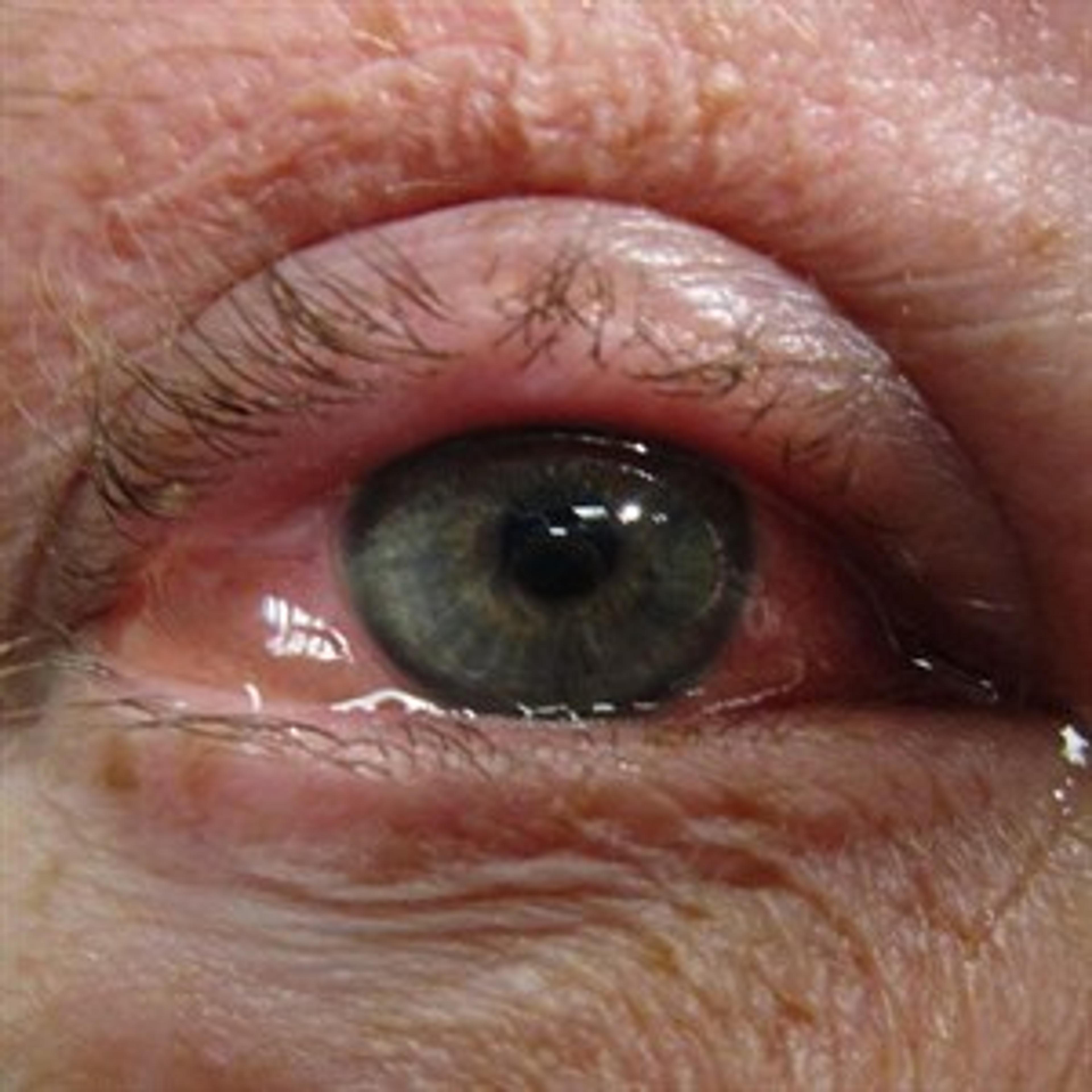 A Sight For Sore Eyes