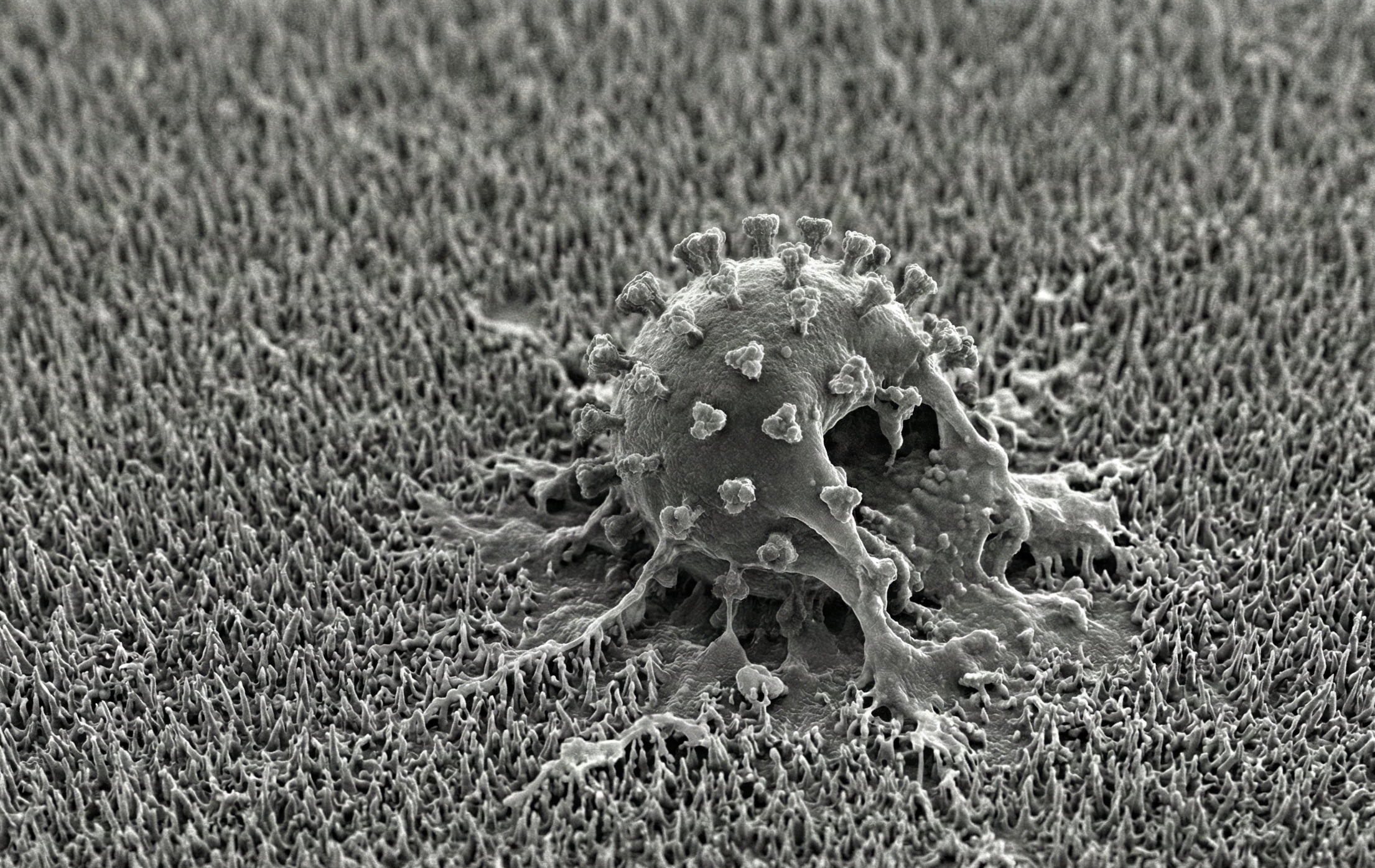 rappresentazione artistica grafica nanostrutture R21 sul fondo che distruggono e lidono un virus