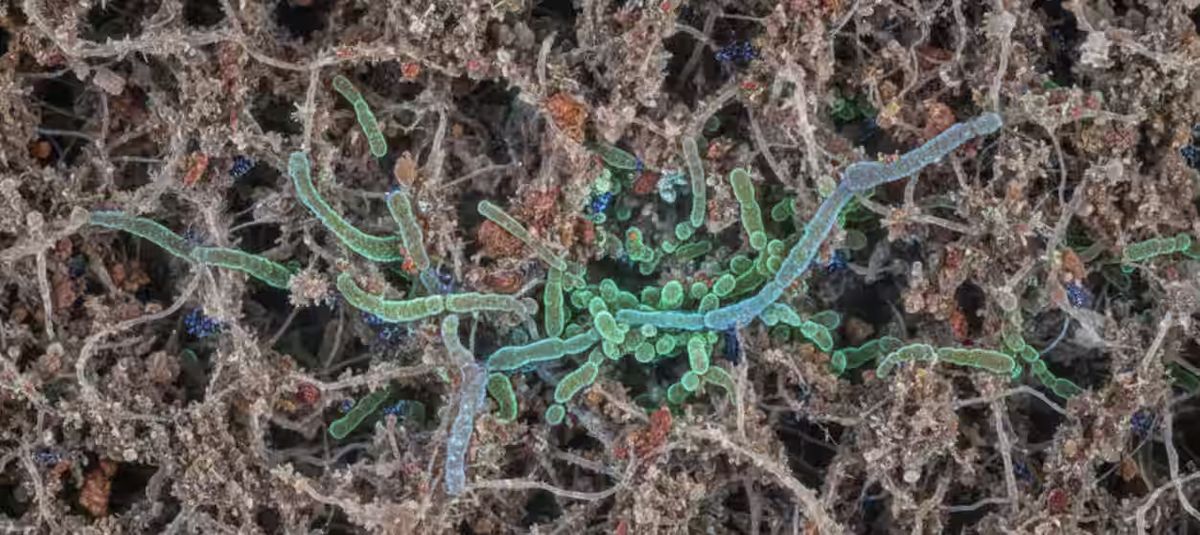 immagine artistica legionella nei filtri al microscopio