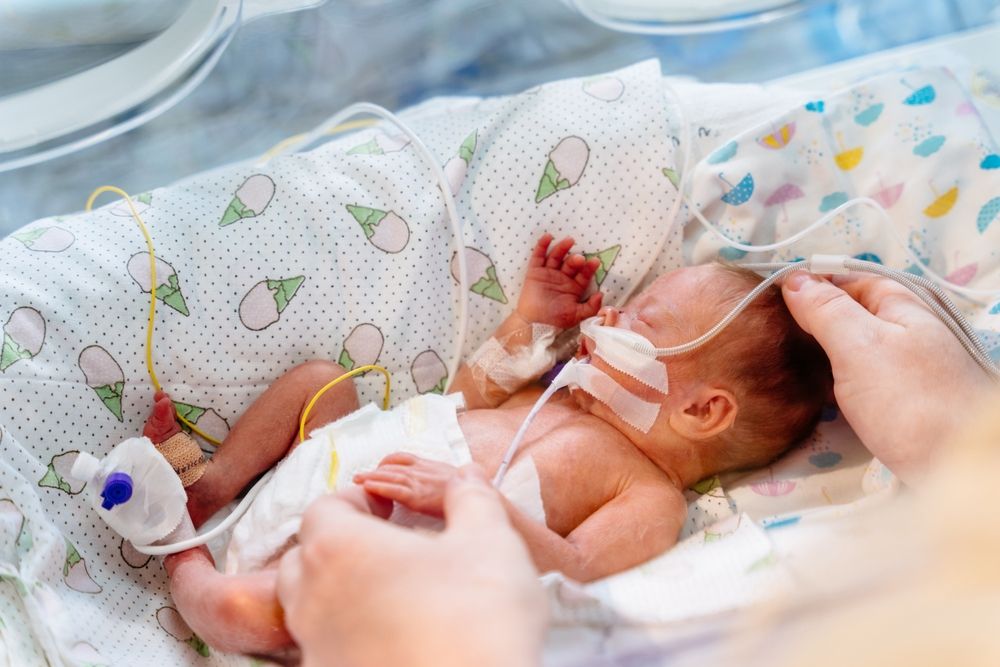 A premature baby receiving intensive care in a medical incubator, highlighting the importance of documentation during a NICU admission after delivery.