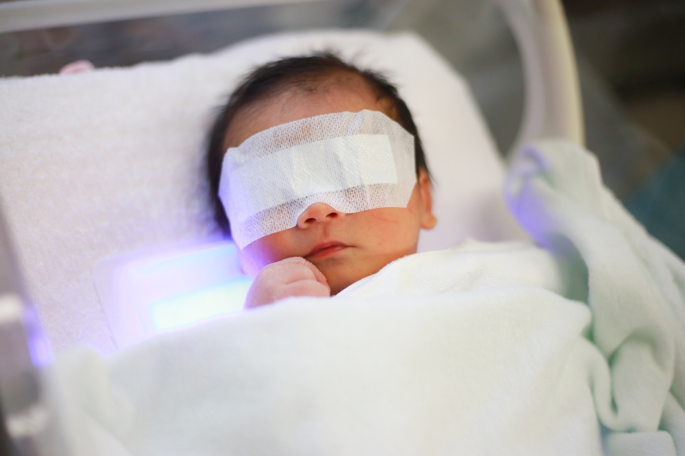Image Can Delayed Treatment of Jaundice Be Medical Malpractice?