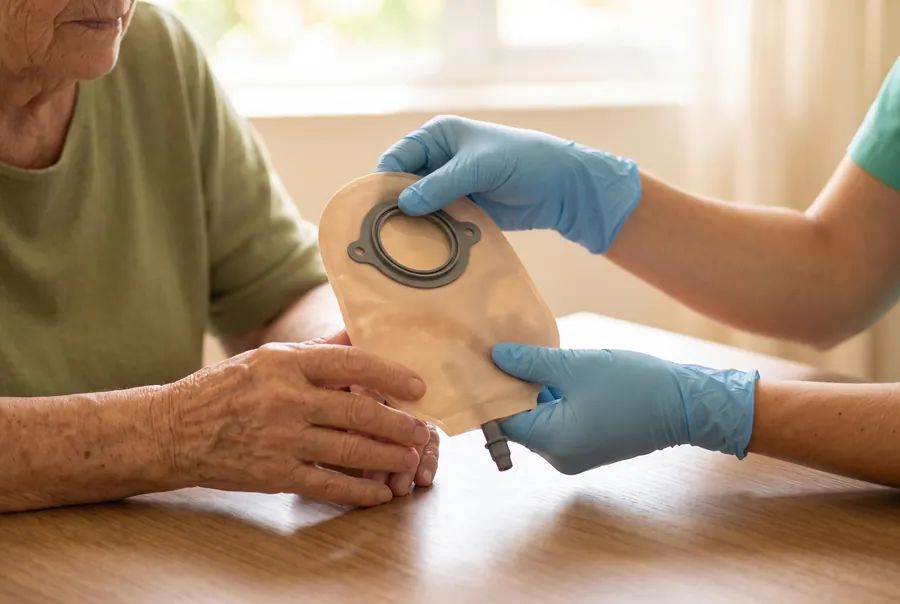 Mãos com luvas mostrando a bolsa de estomia a uma paciente idosa