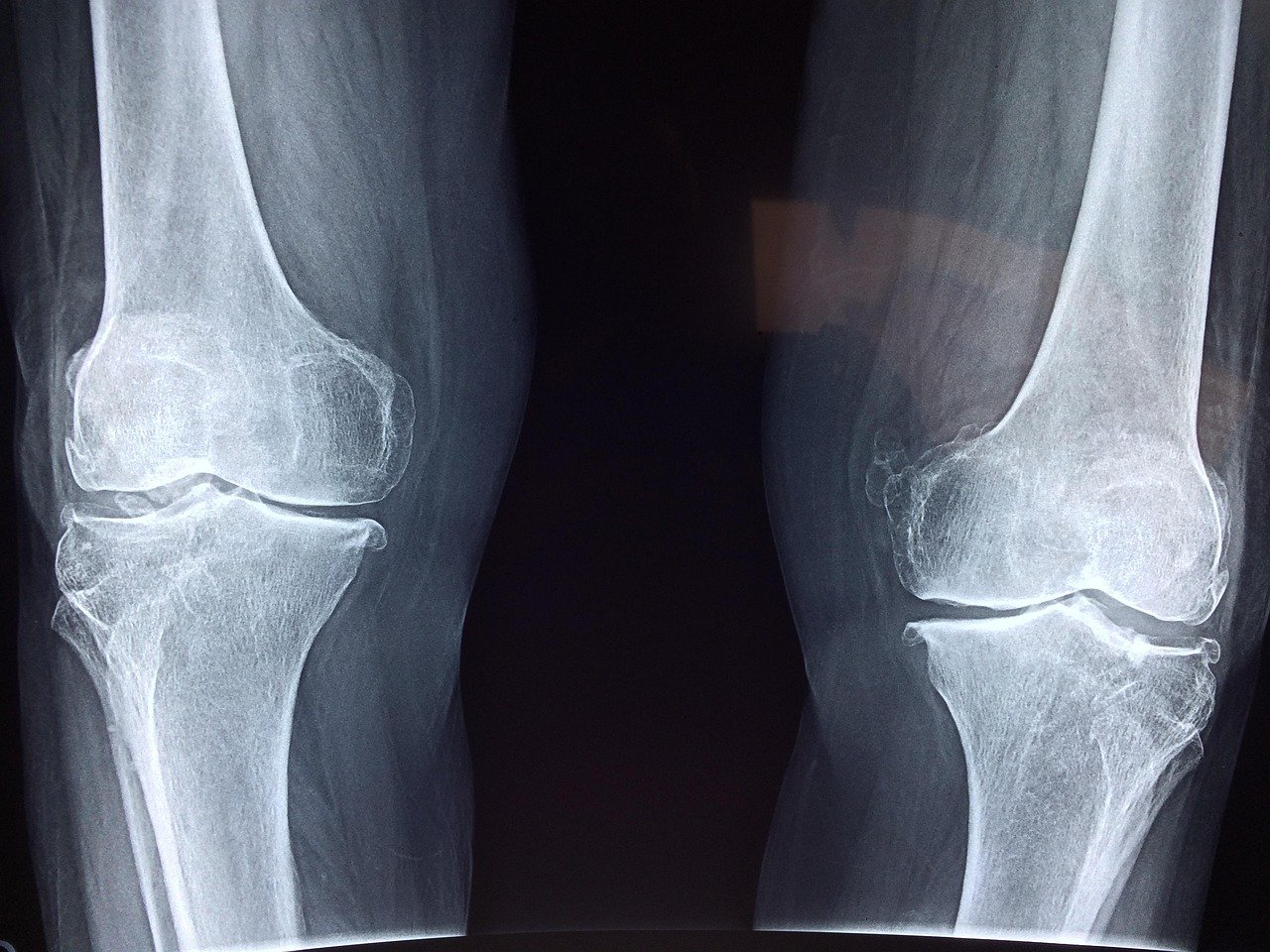 Was macht ein Orthopäde eigentlich? – Fachgebiet und typische Beschwerden