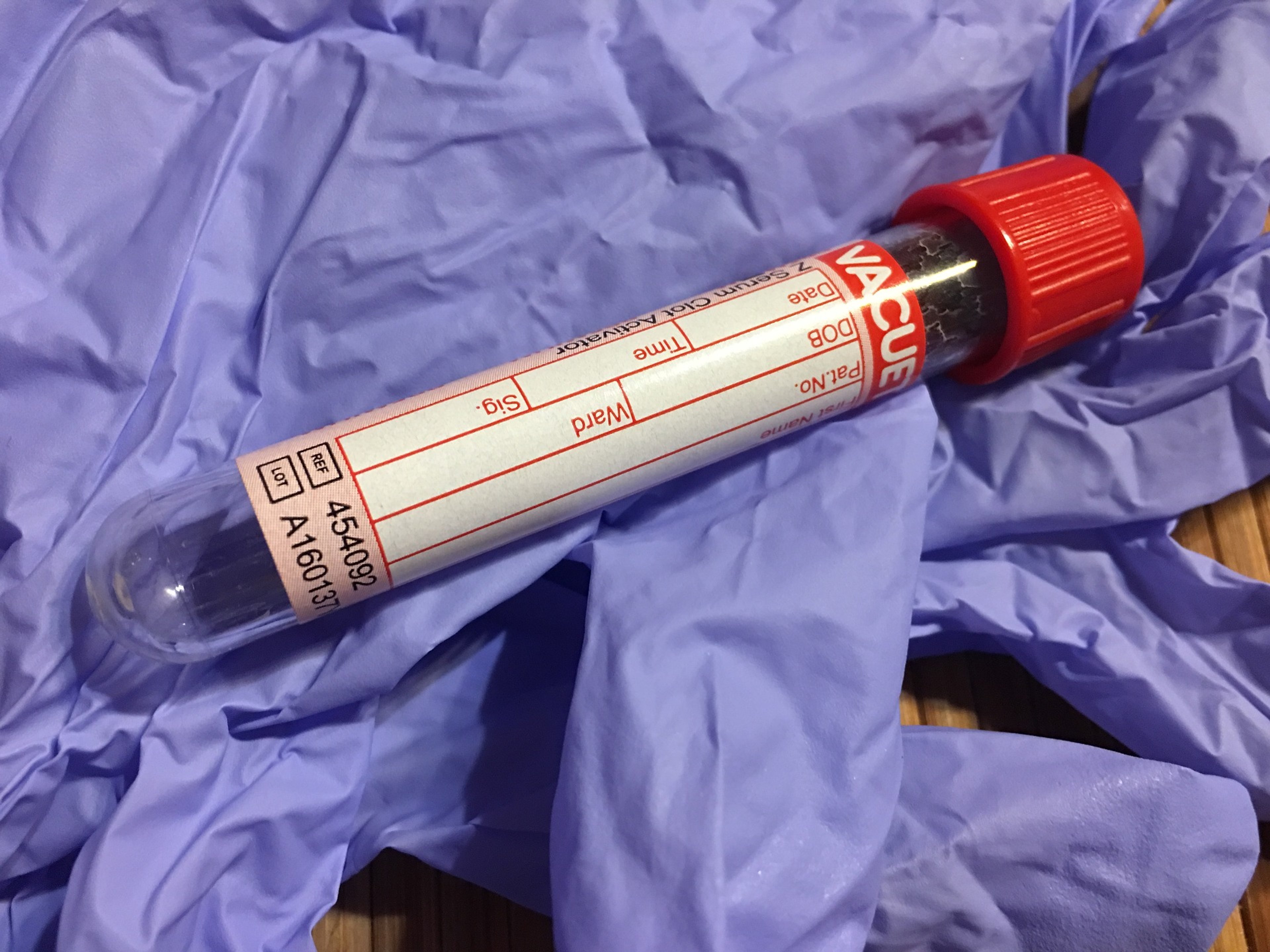 Selbsttest für HIV - AIDS-Test zuhause machen