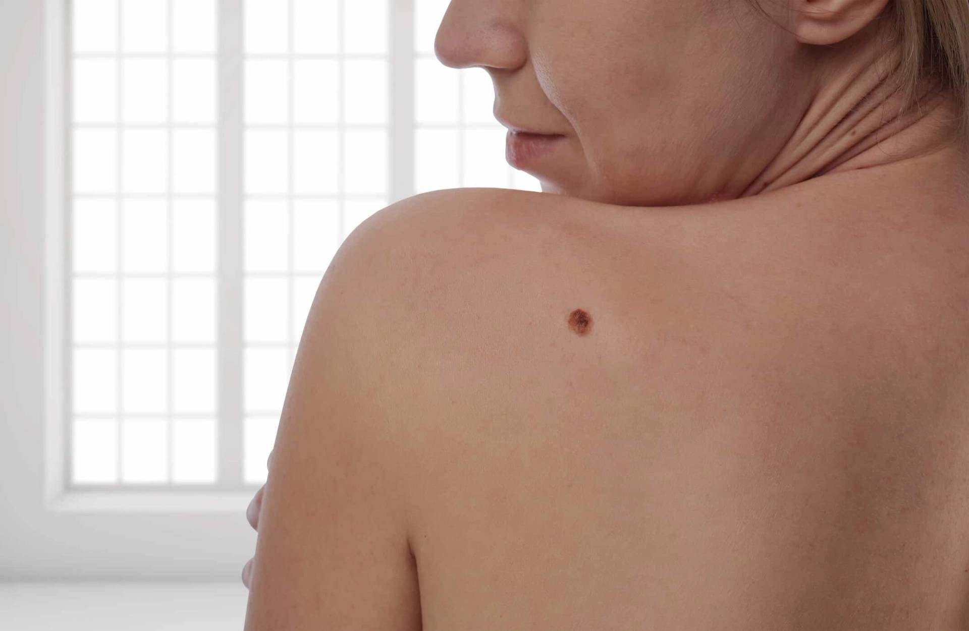 Personne regardant un grain de beauté sur son épaule.