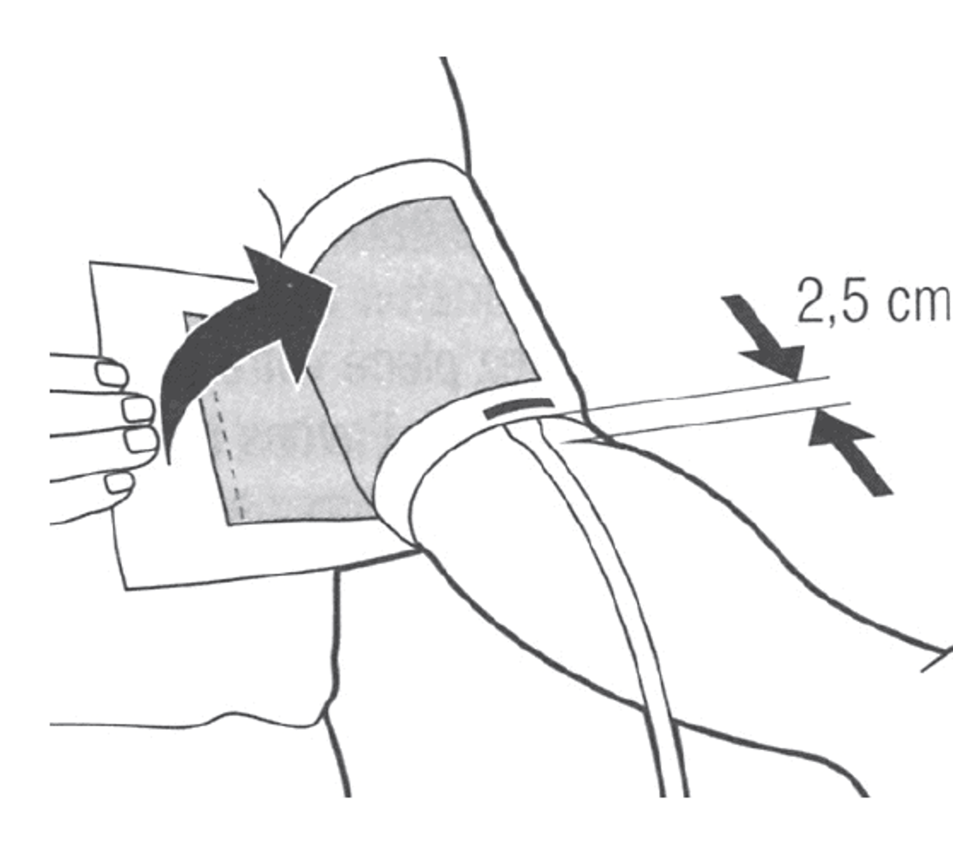 Dessin d’un brassard de tension sur le bras, avec un repère « 2,5 cm » au-dessus du coude.