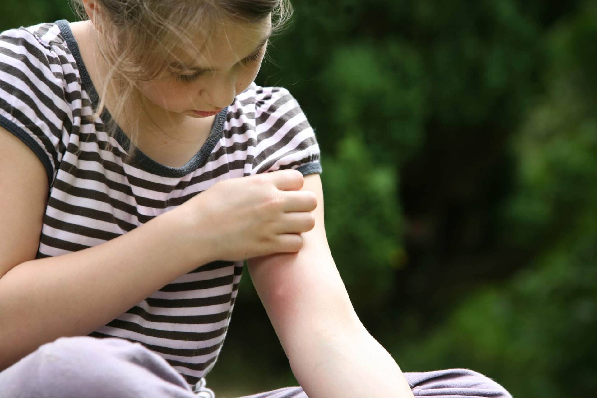 Enfant se grattant le haut du bras.