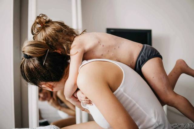 Adulte portant un enfant présentant des boutons sur le dos.