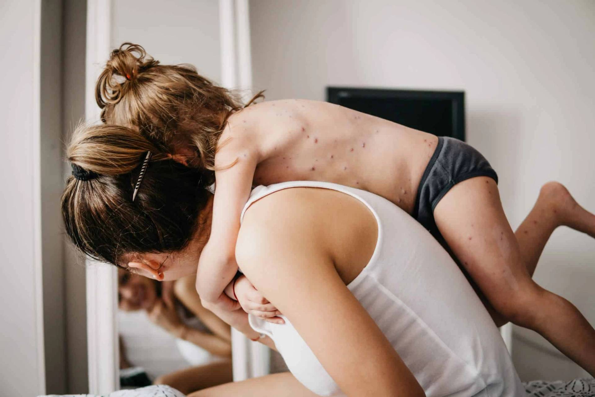 Adulte portant un enfant présentant des boutons sur le dos.