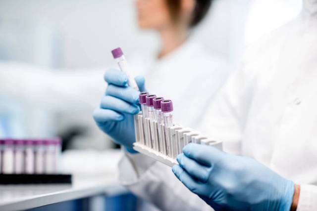 Une personne portant des gants manipule des tubes de prélèvement au laboratoire.