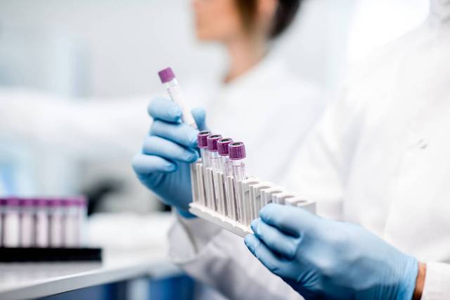 Une personne portant des gants manipule des tubes de prélèvement au laboratoire.