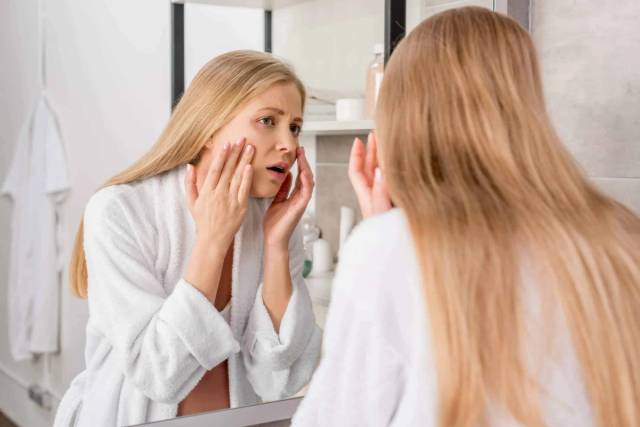 Femme enceinte présentant des taches brunes sur le visage caractéristiques du masque de grossesse