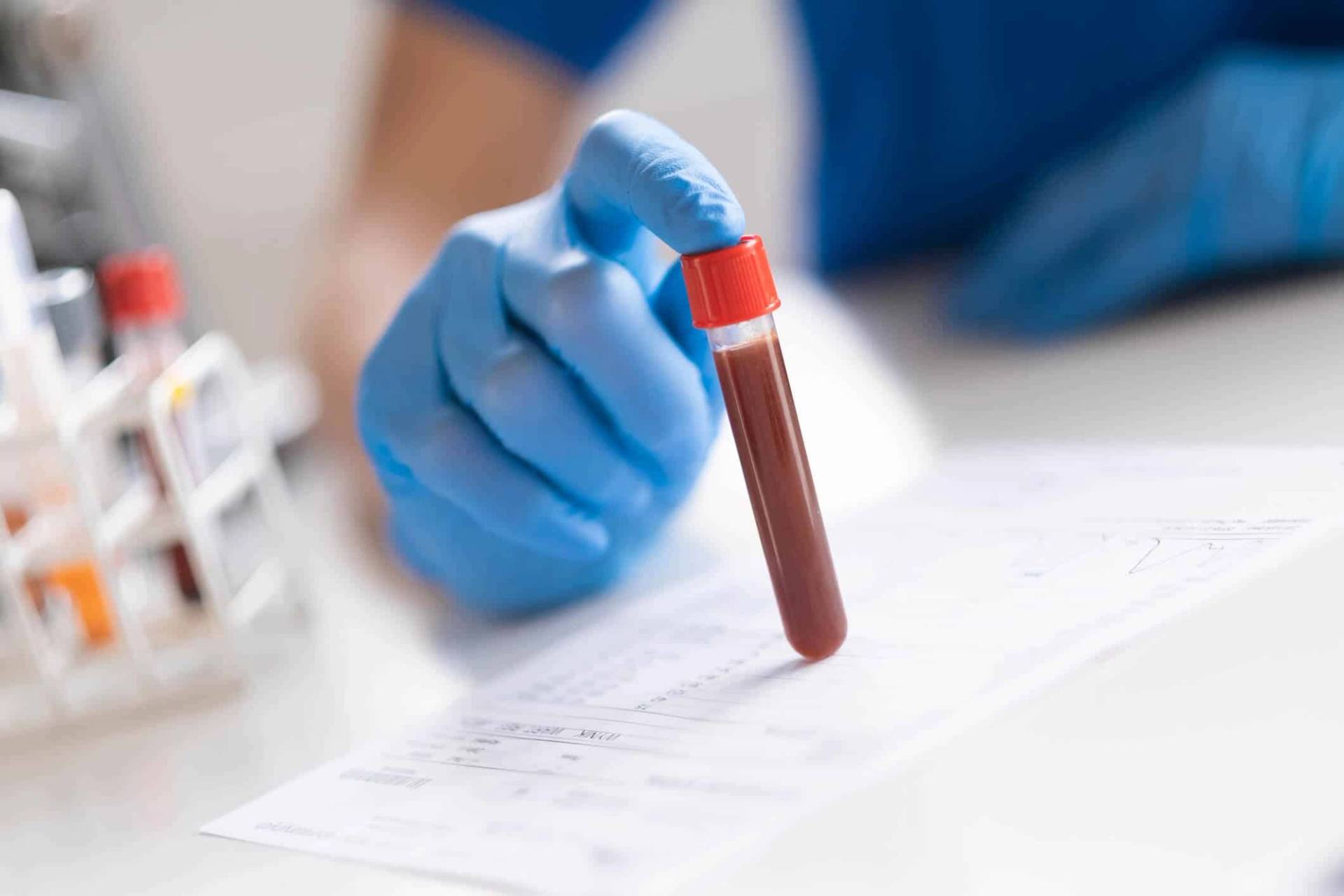 Main gantée tenant un tube de sang à bouchon rouge au-dessus d’une feuille de résultats d’analyse.