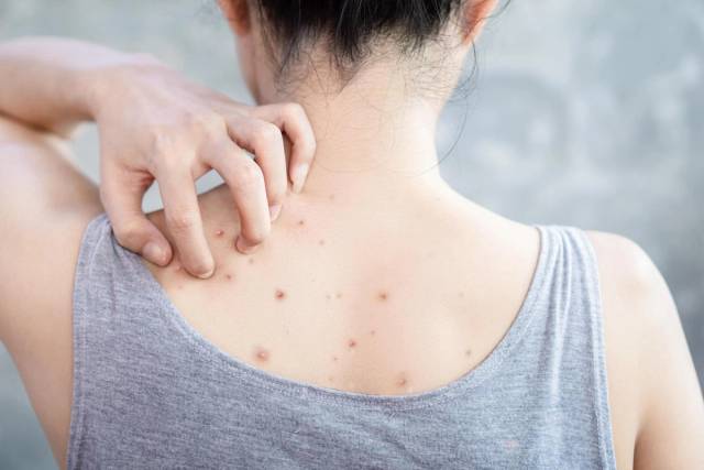Une personne touche son dos où apparaissent plusieurs boutons.