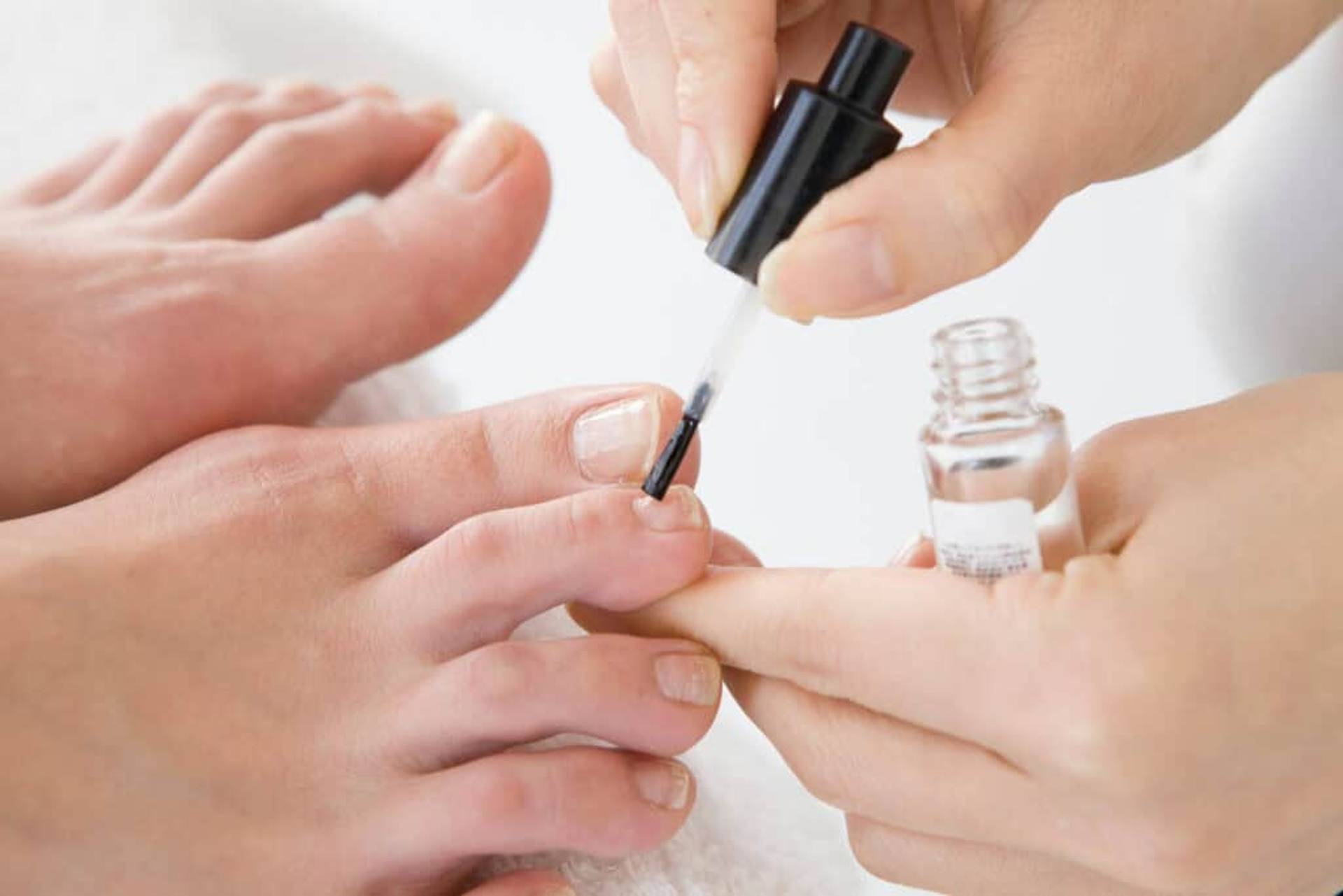 vernis antifongique mycose du pied