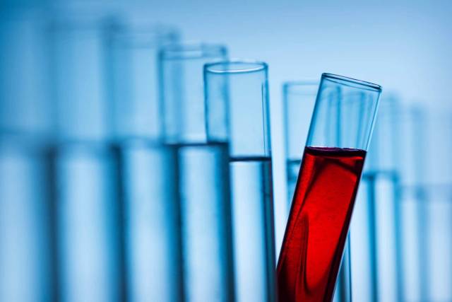 Un tube à essai incliné contenant un liquide rouge se démarque au premier plan devant une rangée de tubes remplis d'un liquide transparent