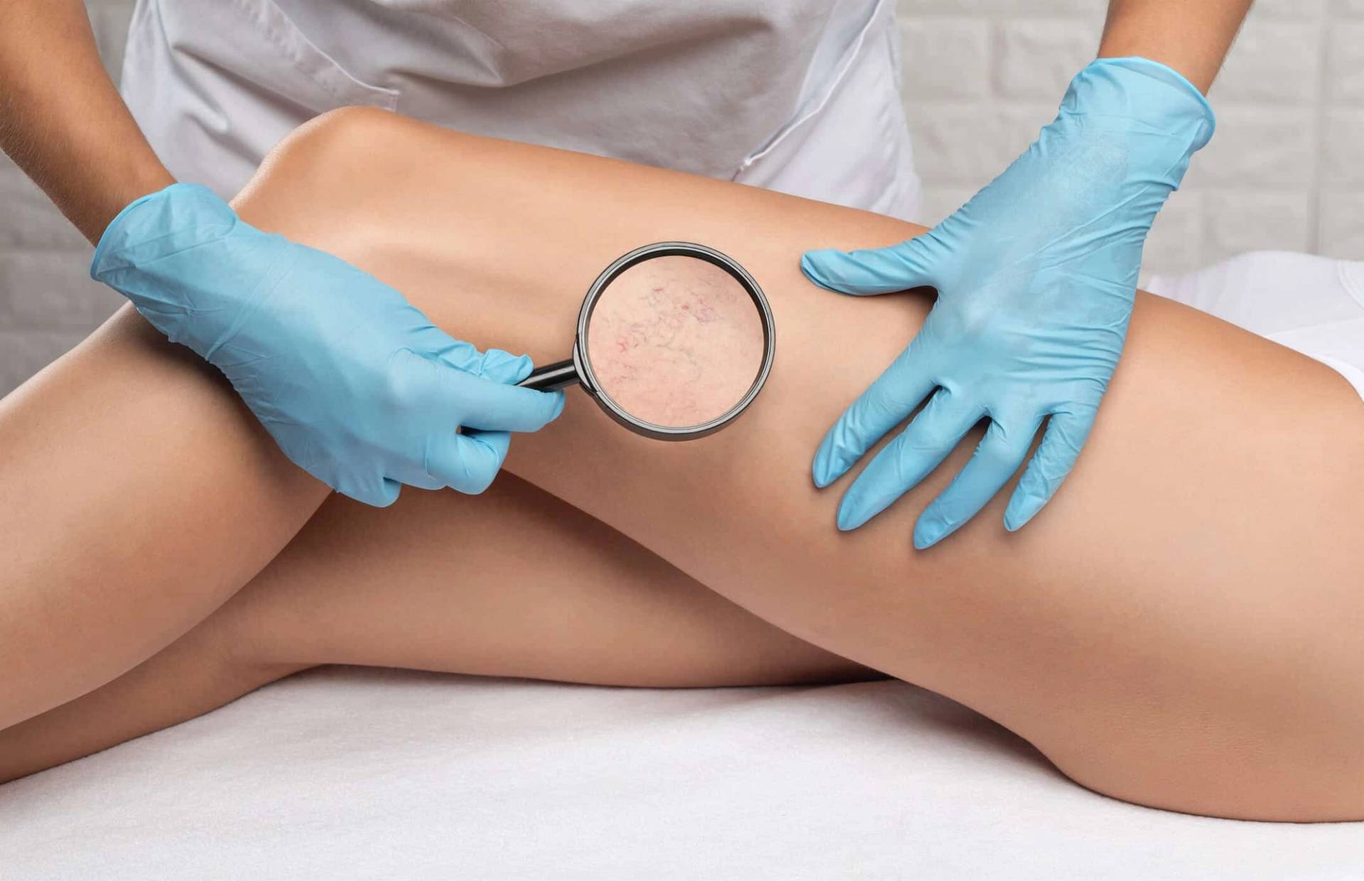 Médecin examinant les jambes d'une patiente pour évaluer un traitement des varices