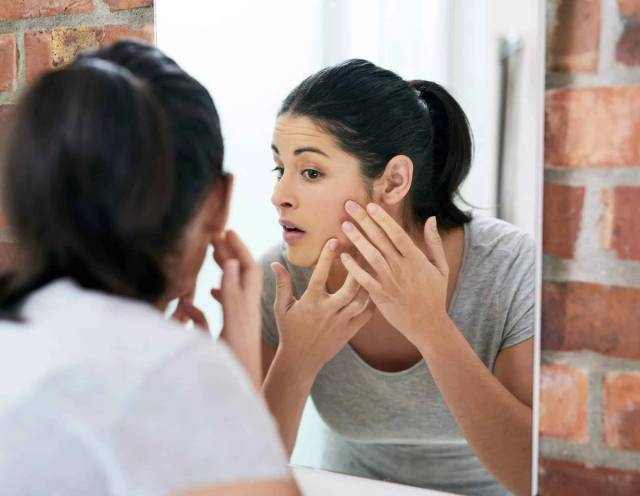L’acné chez les adolescents