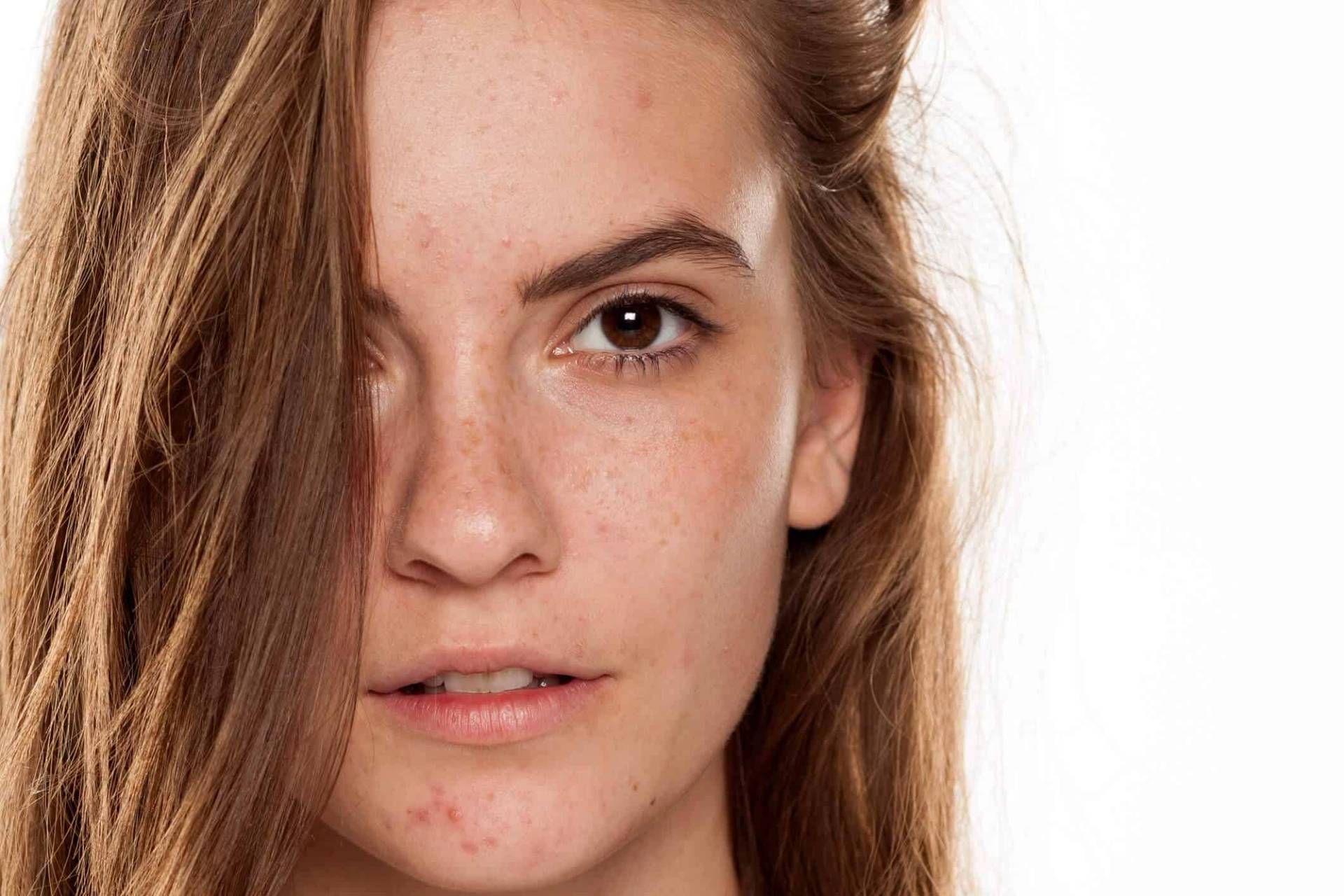 Portrait rapproché d’une femme avec des boutons visibles sur le visage.