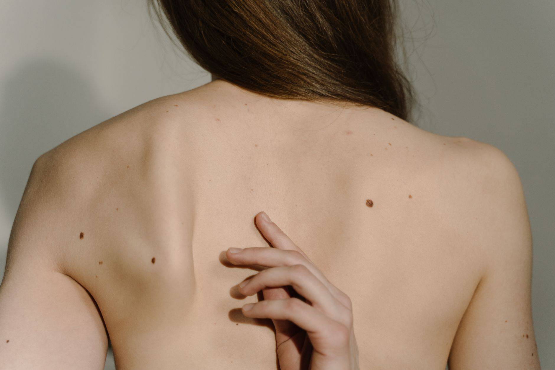 Dos présentant plusieurs grains de beauté, avec une main posée entre les épaules.