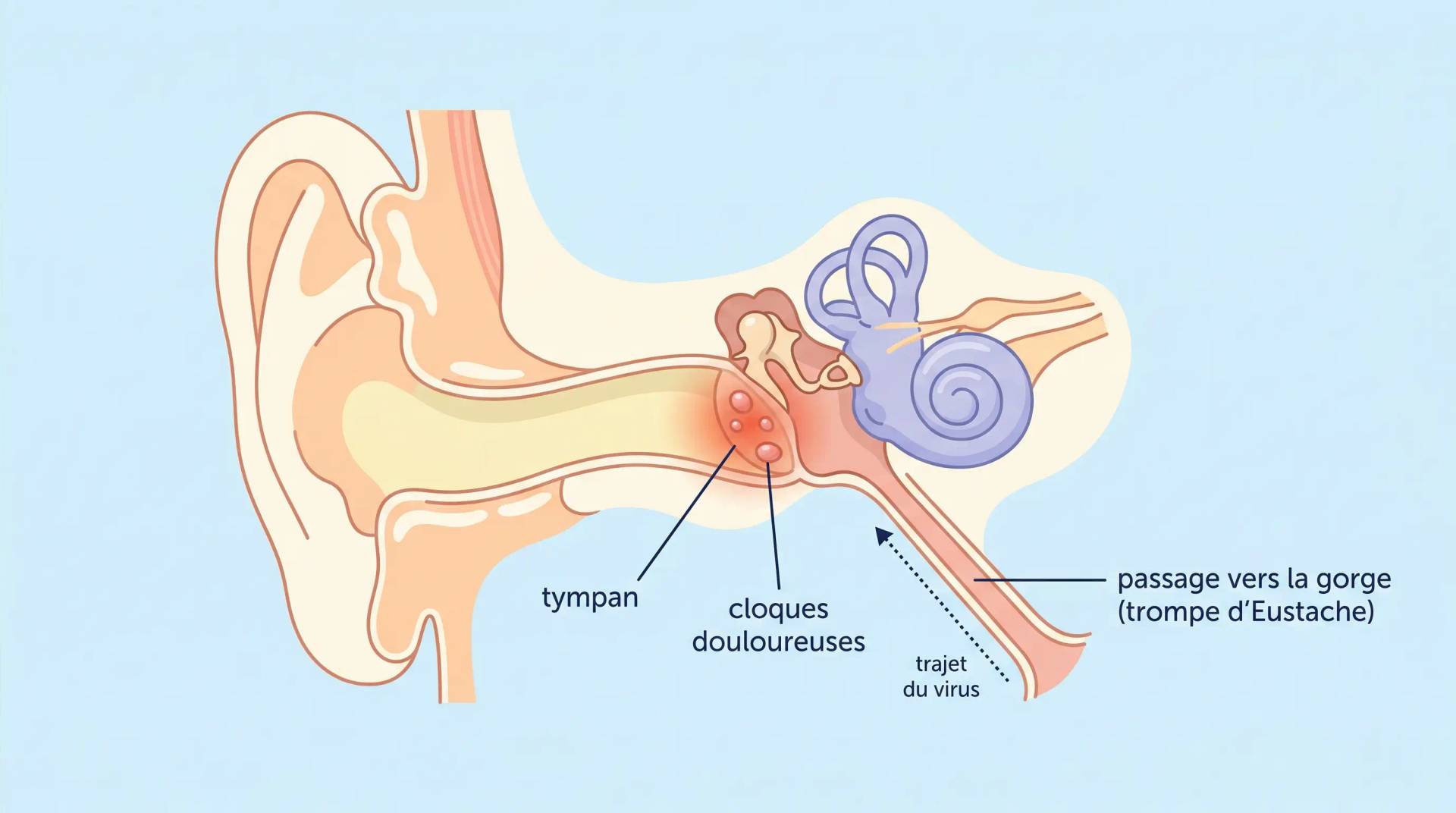 Schéma en coupe de l’oreille avec des repères sur le tympan et la trompe d’Eustache.