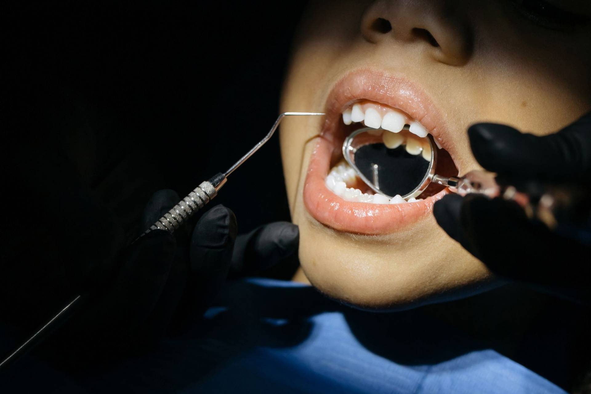 Examen de la bouche d’un enfant à l’aide d’un miroir dentaire.