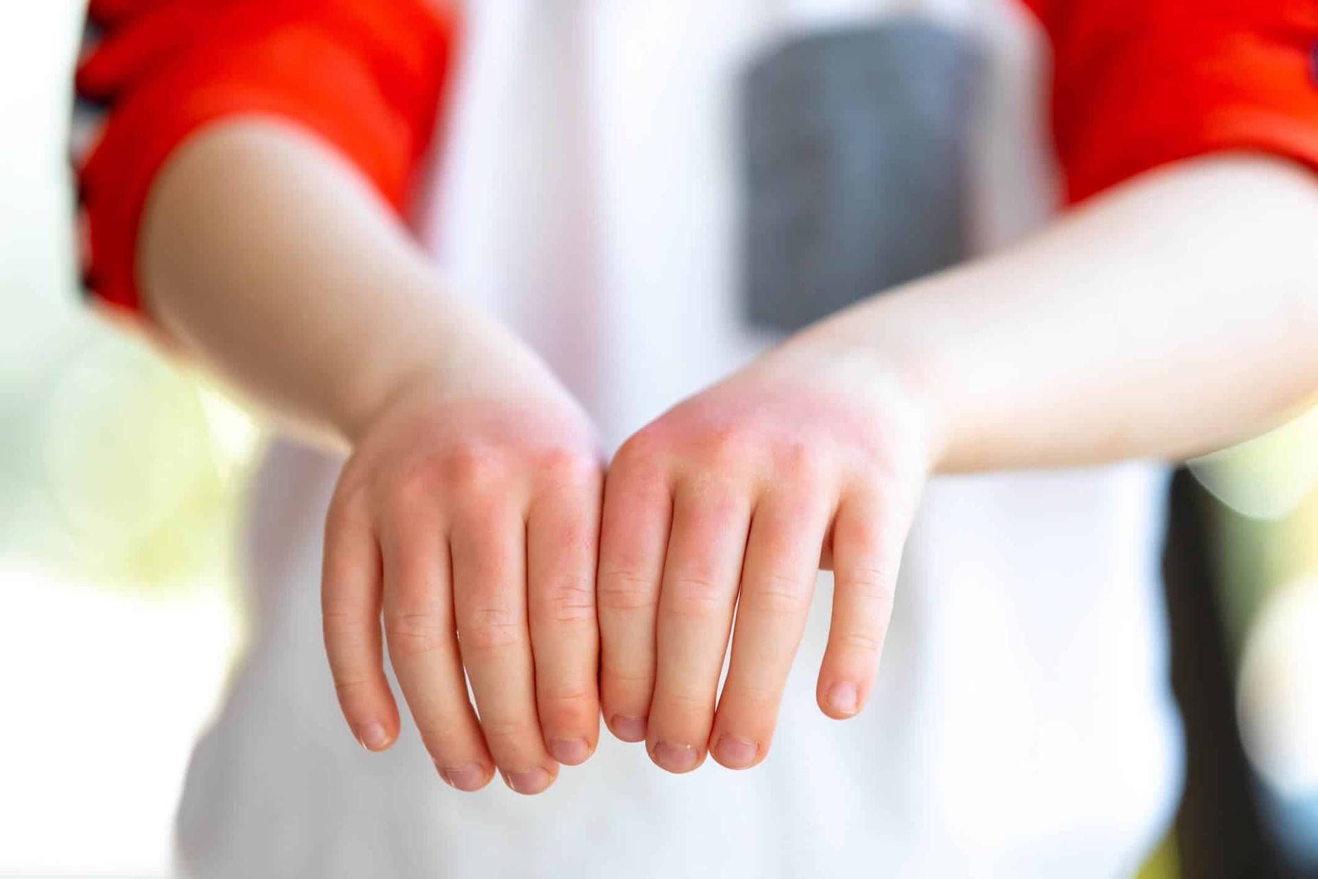 Enfant présentant ses mains rougies.