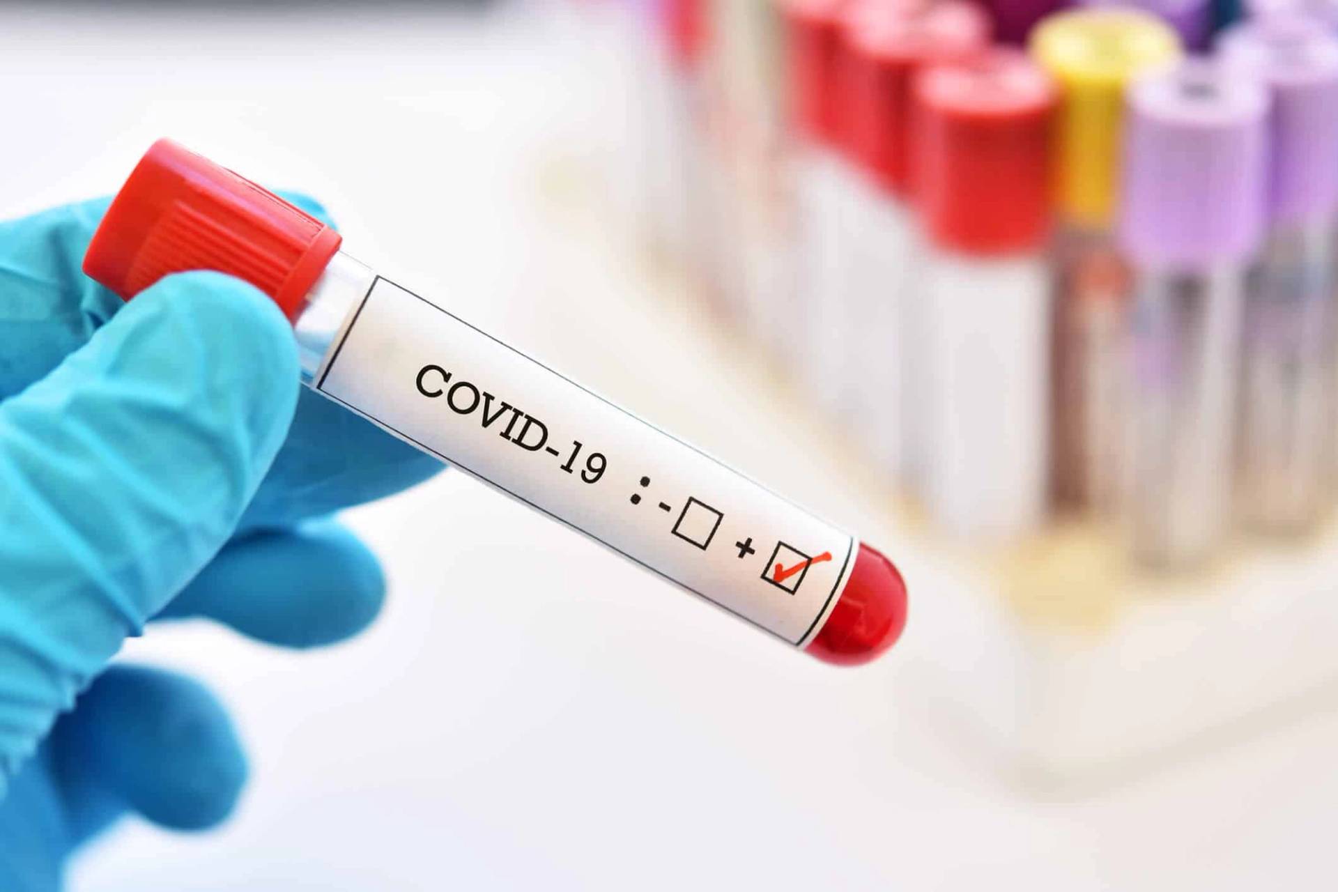 Professionnel de santé effectuant un test sérologique du coronavirus sur un patient