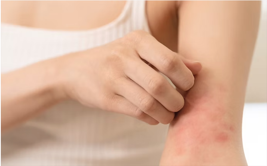 Project Scratch: Unlocking the Gut-Skin Axis