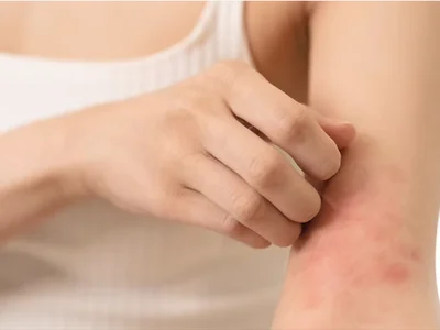 Project Scratch: Unlocking the Gut-Skin Axis