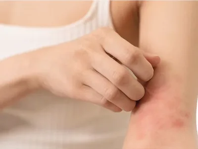 Project Scratch: Unlocking the Gut-Skin Axis